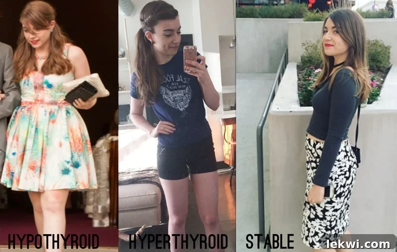 Photos of Michelle in three stages: hypothyroid, hyperthyroid, and stable.